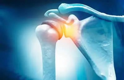 Rotator cuff injury settlements