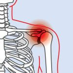 shoulder injuries